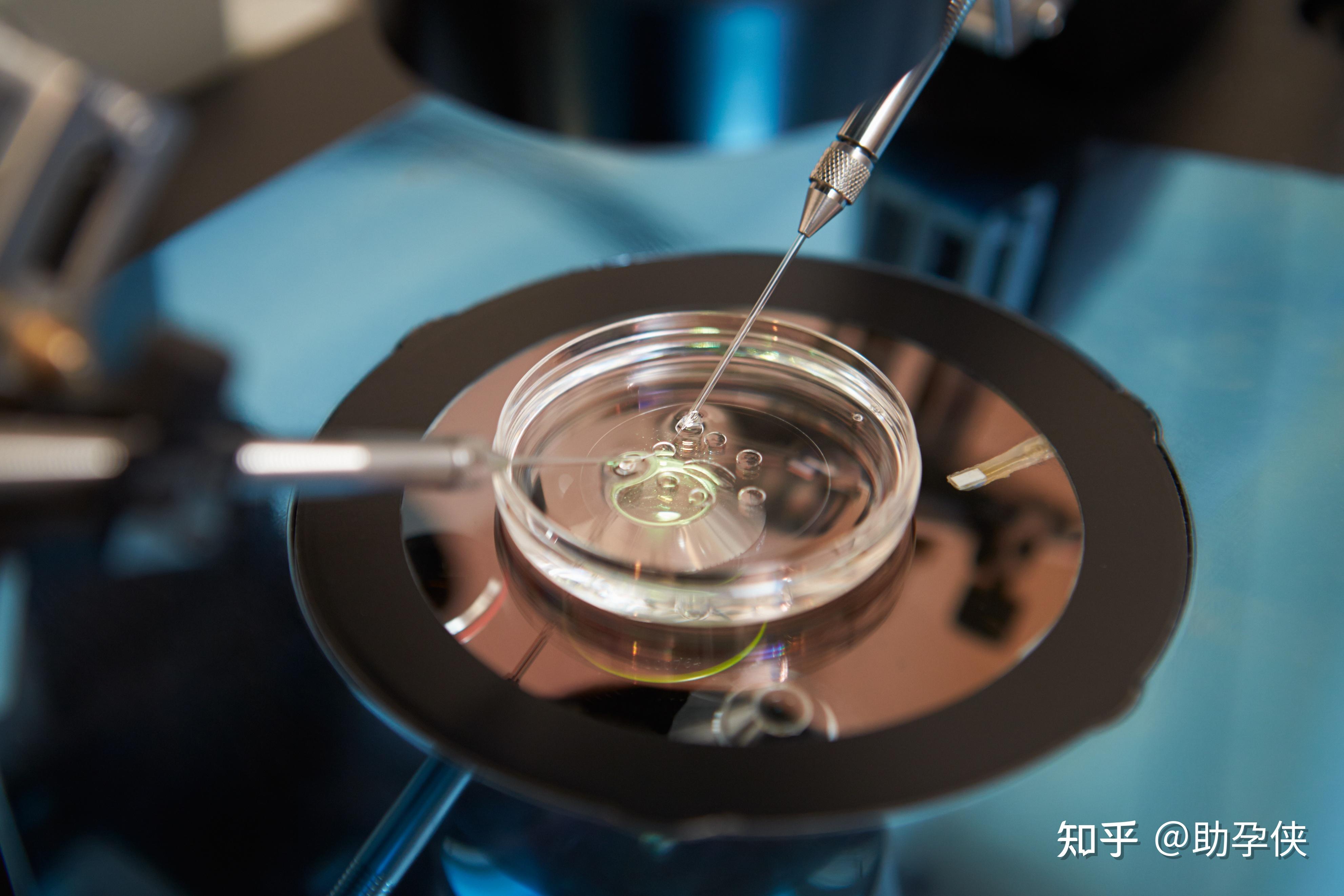 经期腹痛