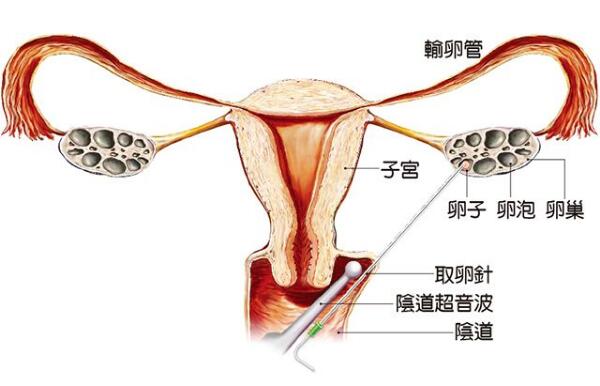 经期血块