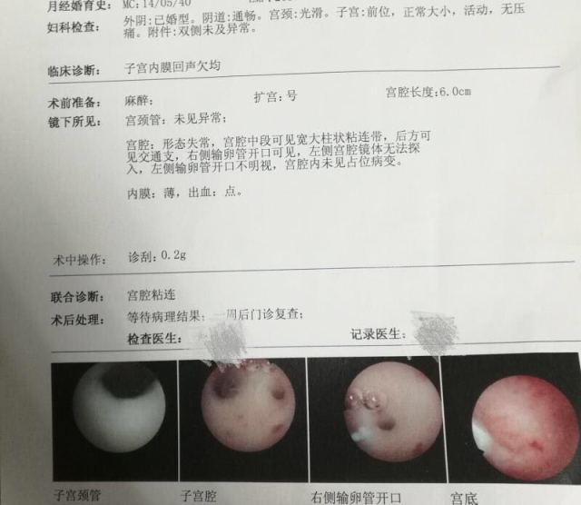 经期血块多