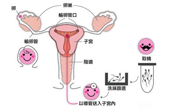 月经血块